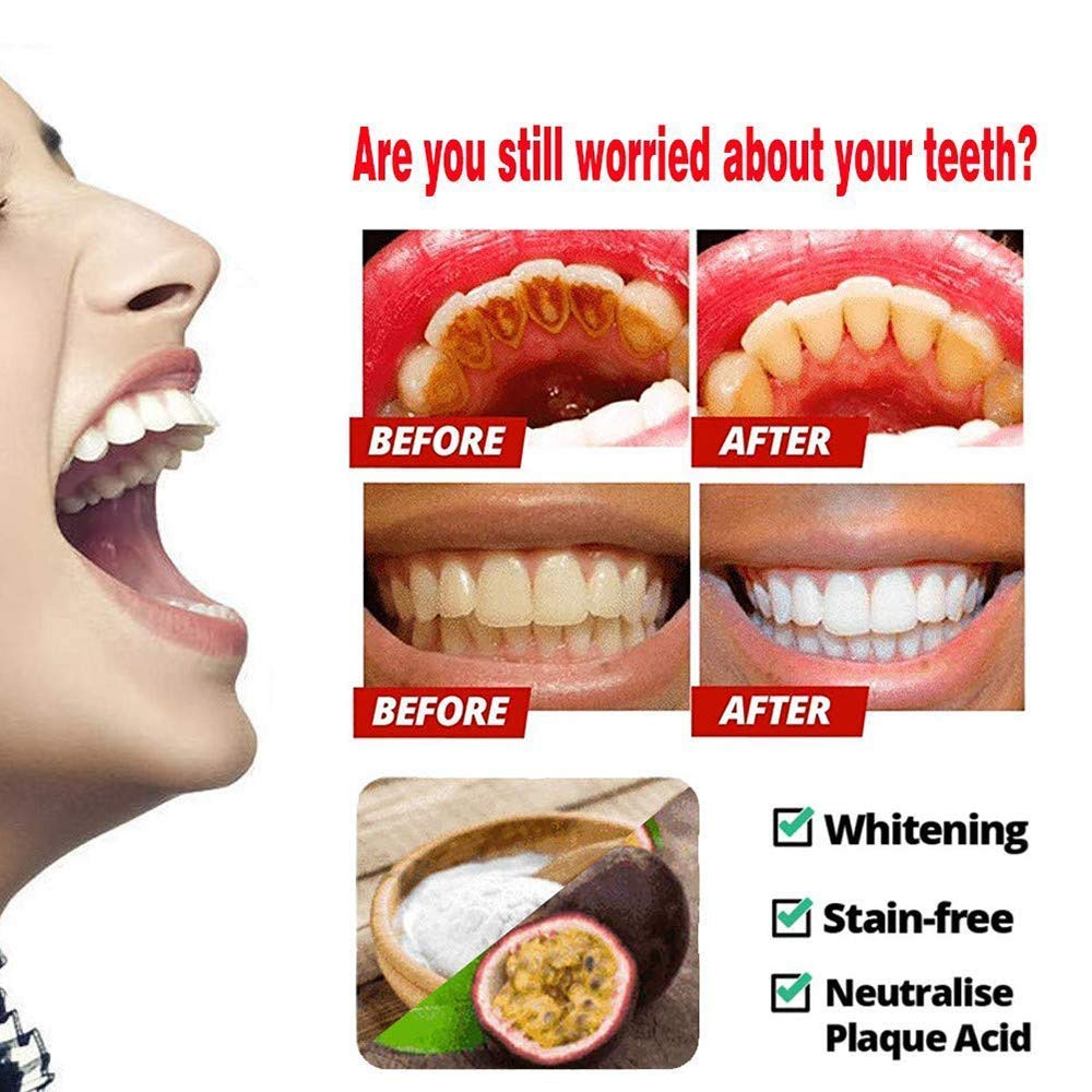 Teeth Whitening Soda Toothpaste Cleaning Stain Removal